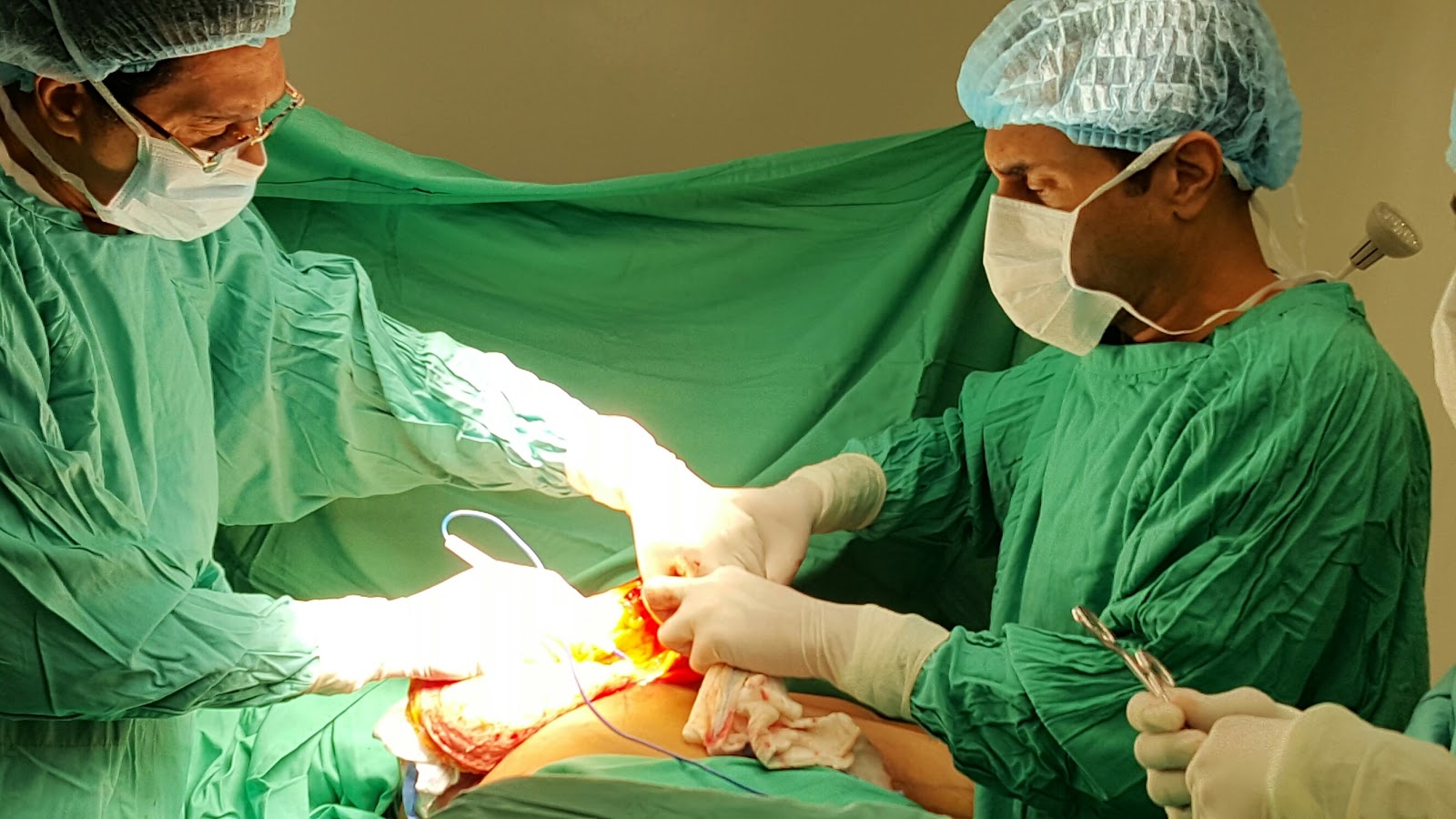 Los cirujanos doctor Edgar Contreras, Víctor Medrano y Domingo Durán durante la intervención quirúrgica de gigantomastia a una de las pacientes operada gratuitamente el sábado en Be Center