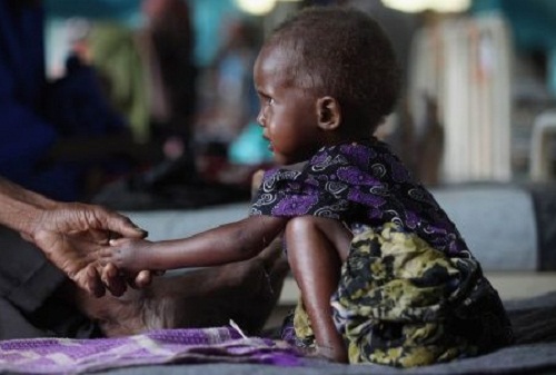 Desnutrición en Kenia