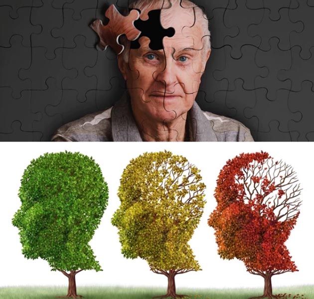 Alzheimer-630-10-1
