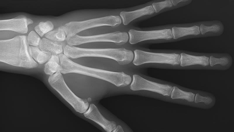 kbc1dmvid6bjq4kqj1lv