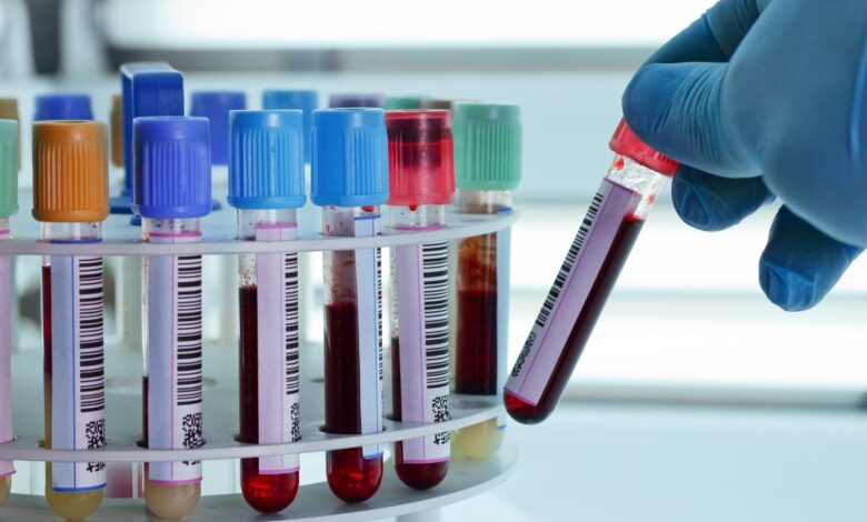 Desarrollan método para detectar enfermedades renales a través de una gota de sangre