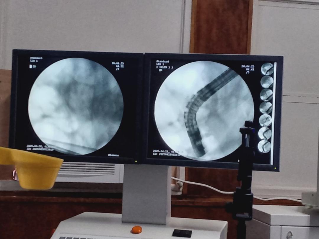 Hospital Universitario de Maracaibo reactivó método para diagnosticar enfermedades