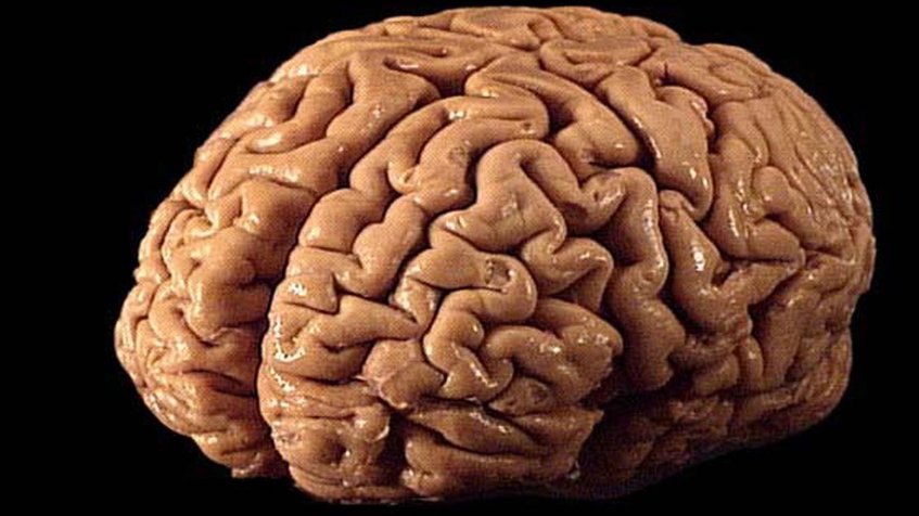 CEREBRO