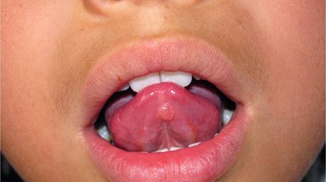 lengua