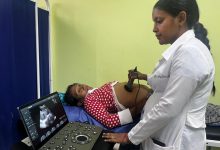 Zulia: Plan Cayapa de la Salud y Plan Quirúrgico Nacional beneficia a 68 pacientes de la Laguna de Sinamaica