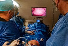 Maternidad Dr. Armando Castillo Plaza impulsa cirugía laparoscópica avanzada