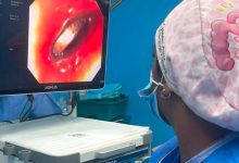 Hospital Universitario de Maracaibo consolida la endoscopia pediátrica de alta complejidad