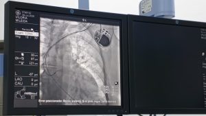 Plan Quirúrgico Nacional garantiza cirugías de alta complejidad en el Hospital Coromoto en Maracaibo
