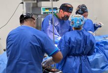 En el Zulia: Jornada Quirúrgica de Hernia Umbilical e Inguinal en el Hospital General Dr. Adolfo D' Empaire de Cabimas